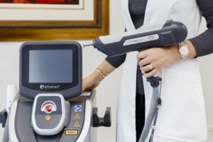 laser cicatrizes acne rafaela salvato